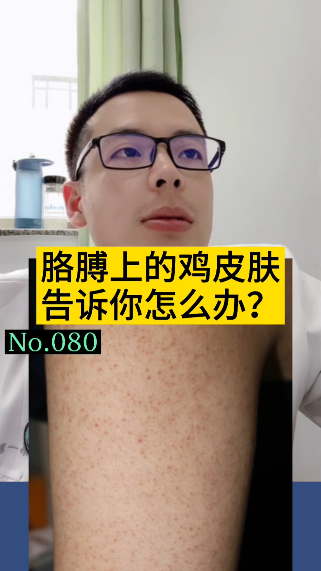 #健康科普#夏天胳膊上起鸡皮肤很烦人,告诉你怎么办!