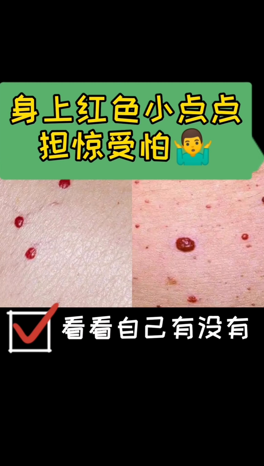 #每天一点冷知识#看看您家里面人有没有这种“红色凸起来小颗粒”