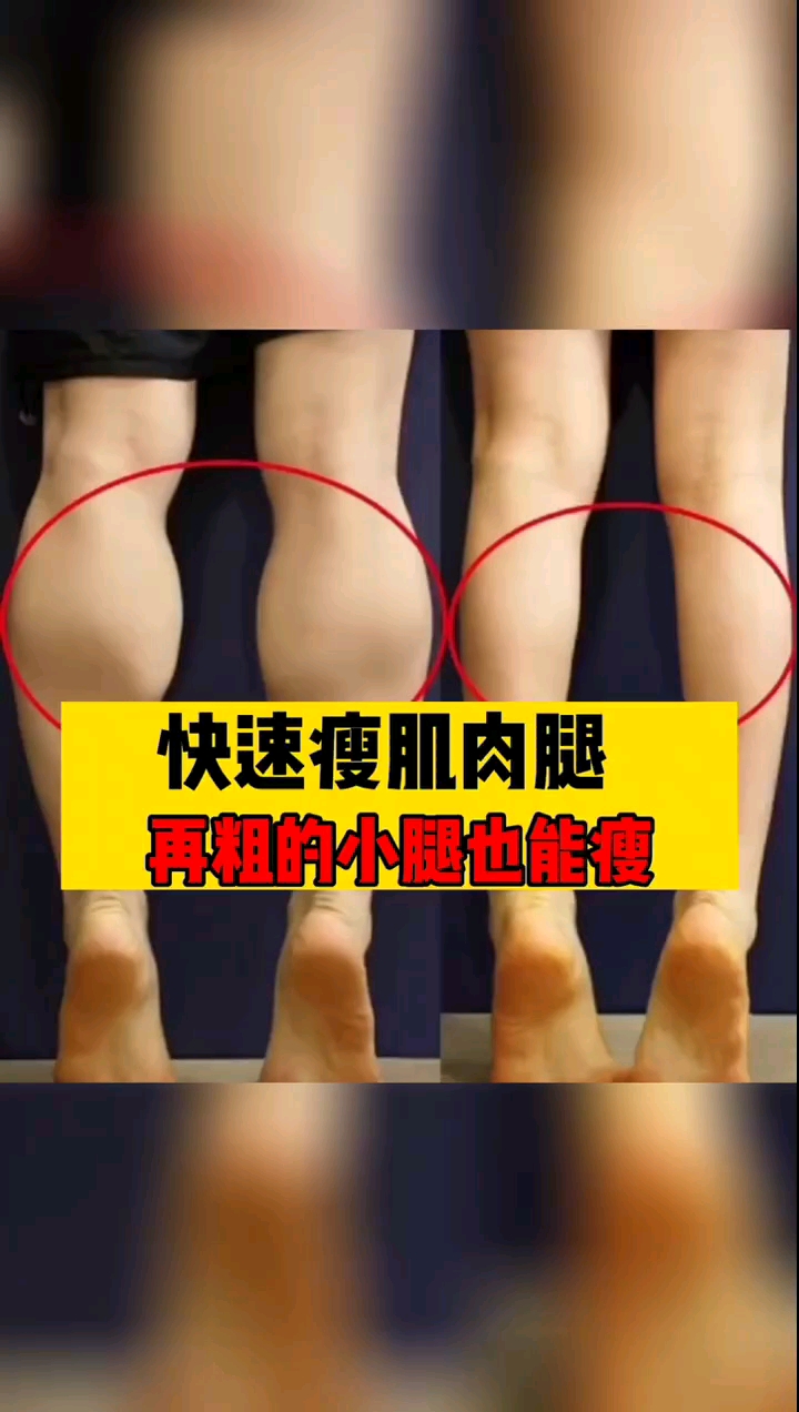 #谁家的姑娘这么漂亮#小腿粗壮、肌肉腿怎么变瘦?
