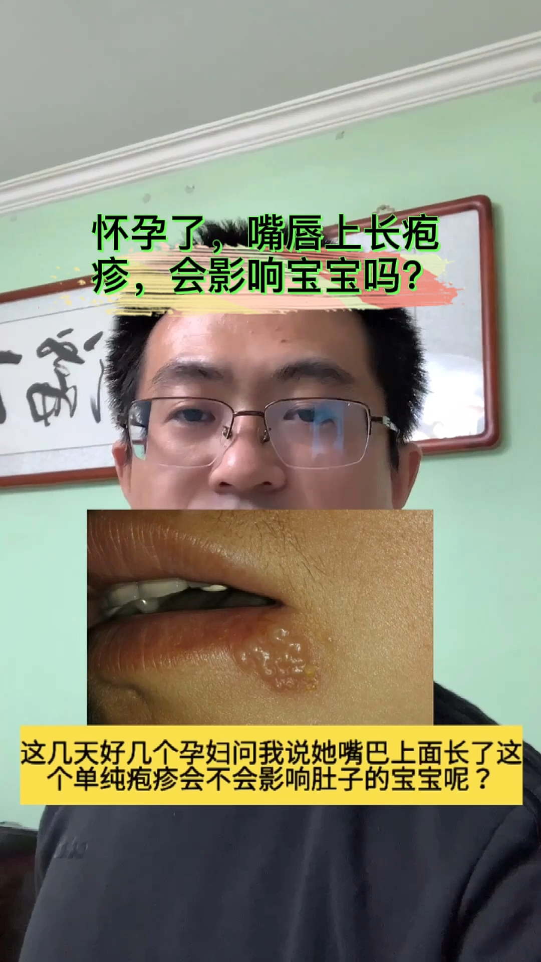 #全民医生说#怀孕了,可嘴唇上长了疱疹,这影响宝宝吗?