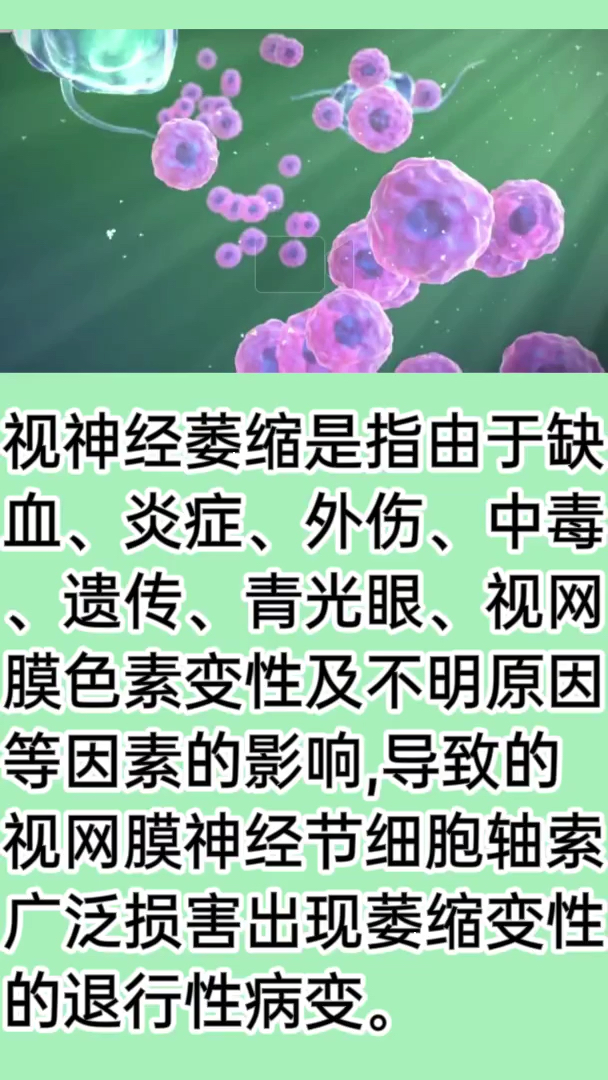#中医#视神经萎缩