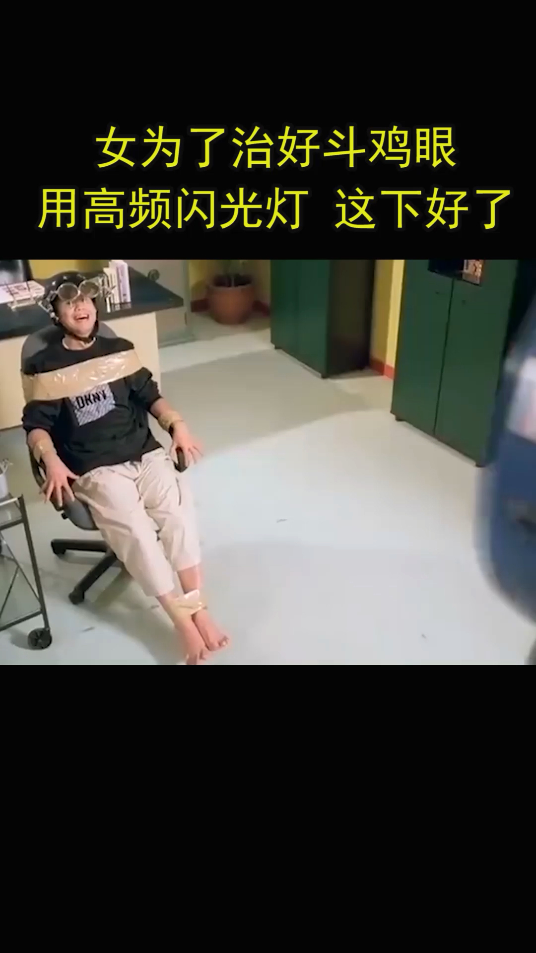 #我要上热门#美女为了治好斗鸡眼，用高频闪光灯