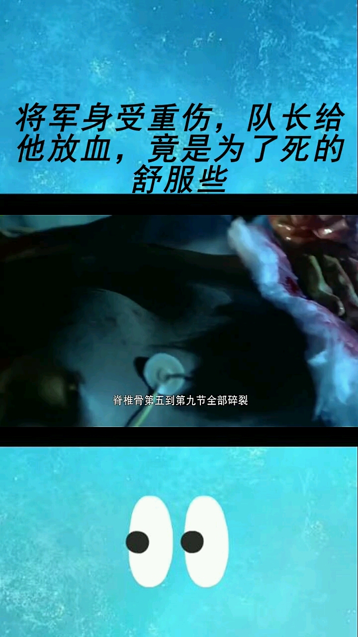 将军身受重伤,队长给他放血,竟是为了死的舒服些
