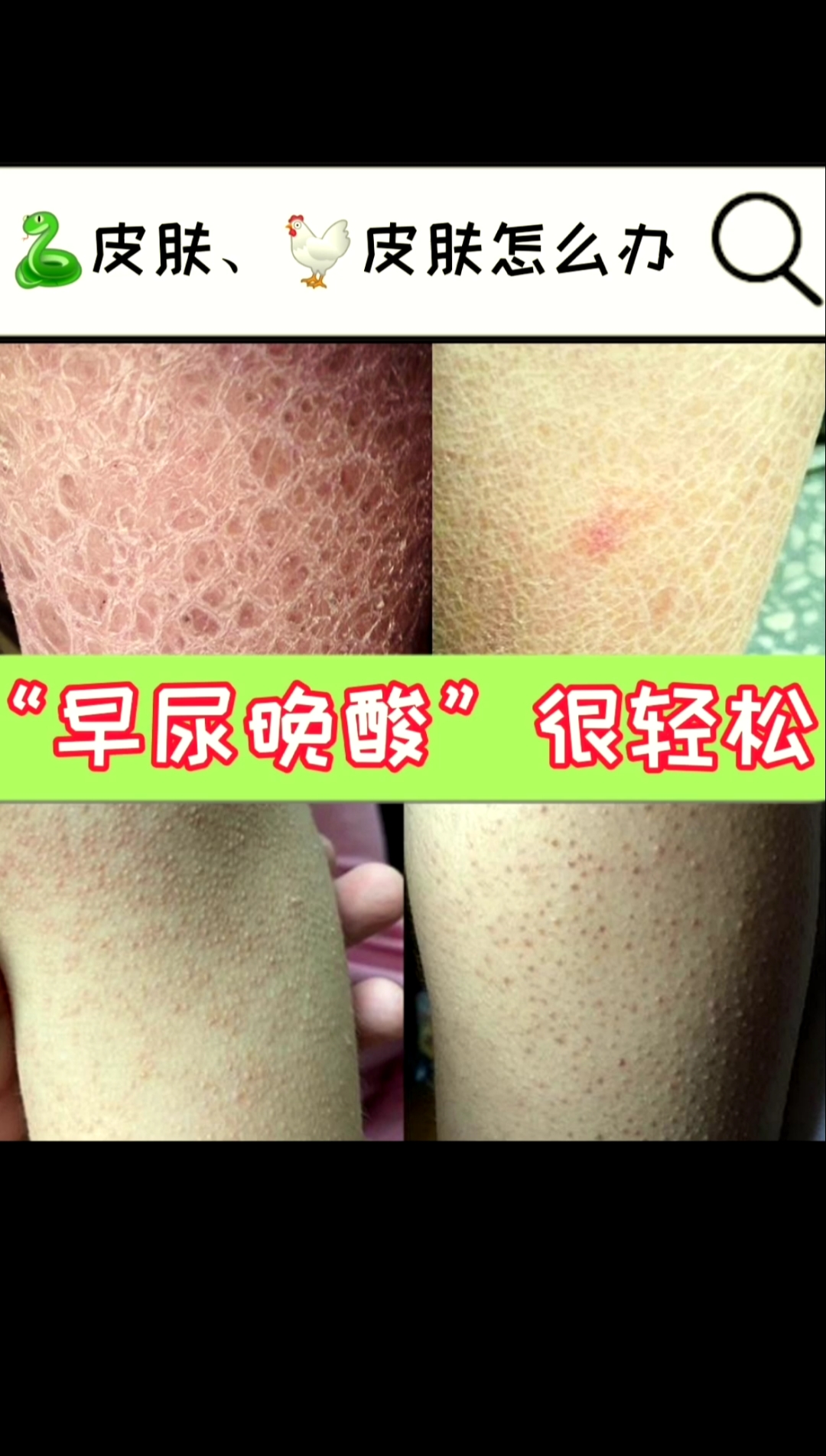 #每天一点冷知识#大腿、手臂粗糙小颗粒怎么办♂