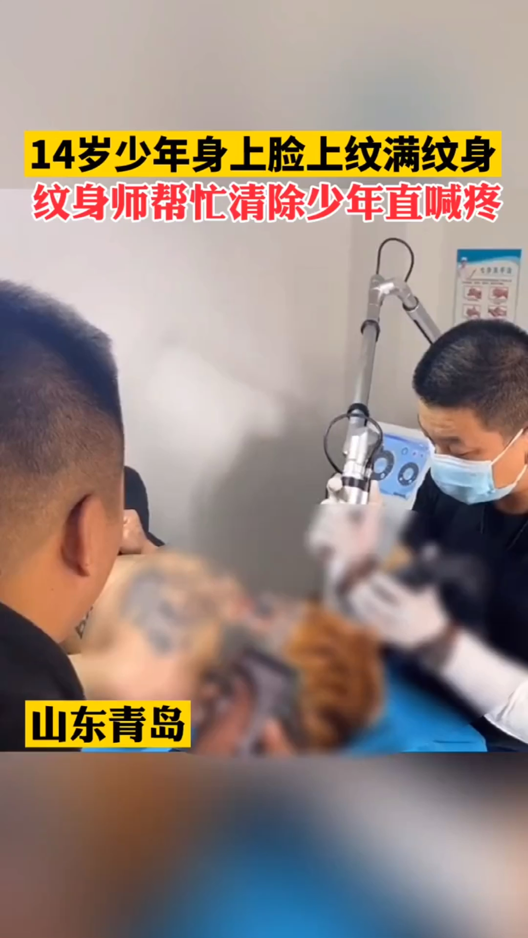 山东青岛14岁少年身上脸上纹满纹身,纹身师帮忙清除少年直喊疼。