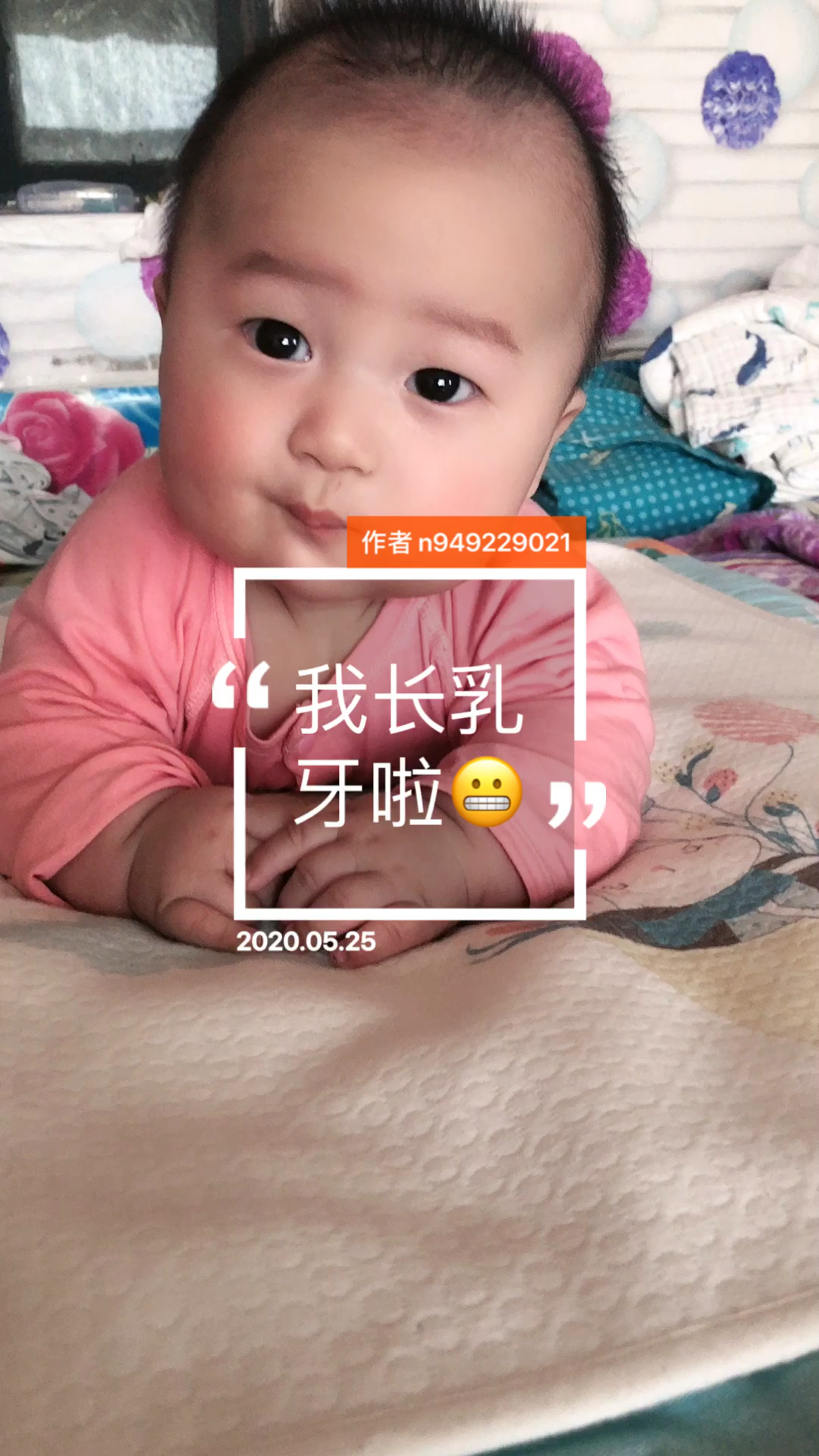 四个月九天,今天发现大宝宝的乳牙长出来啦,冒出来一个尖