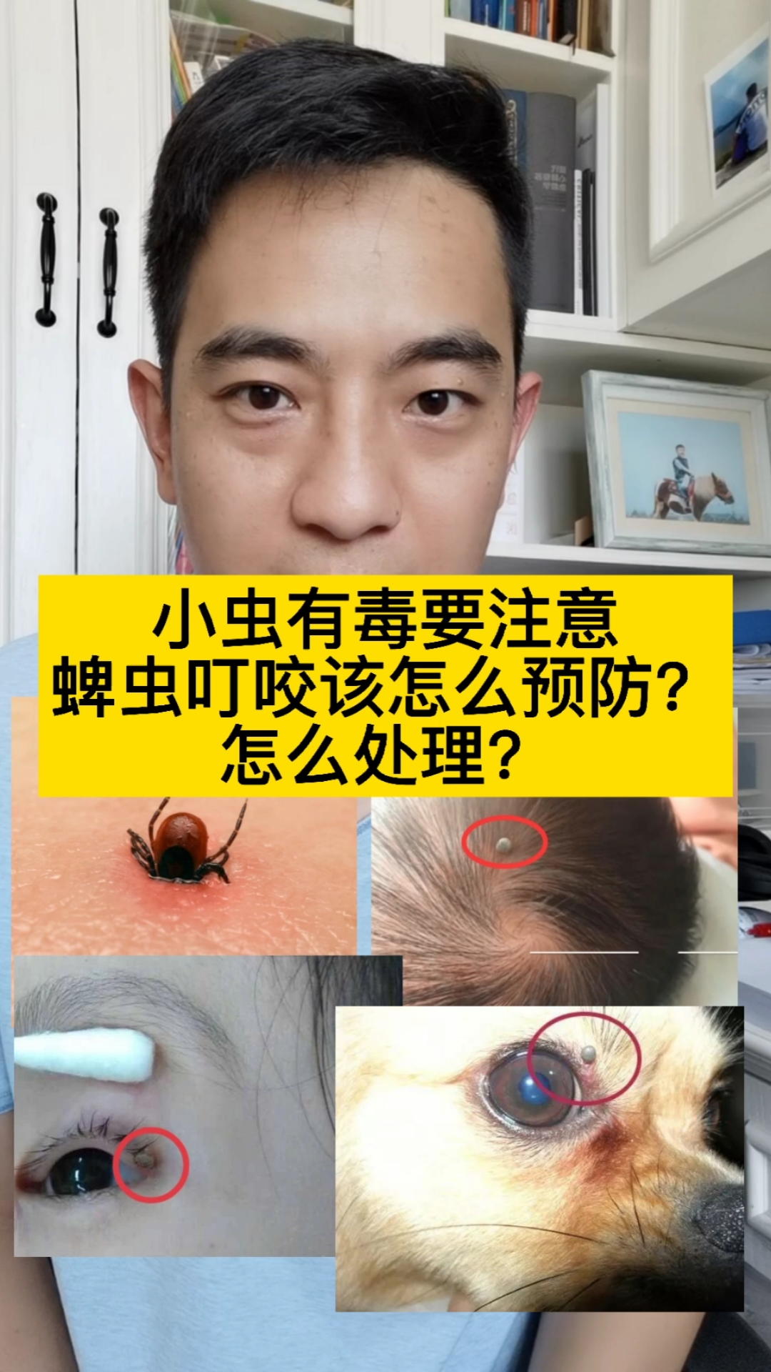 小小蜱虫毒不小,预防处理很重要!蜱虫叮咬怎么预防,又该怎么处理呢?