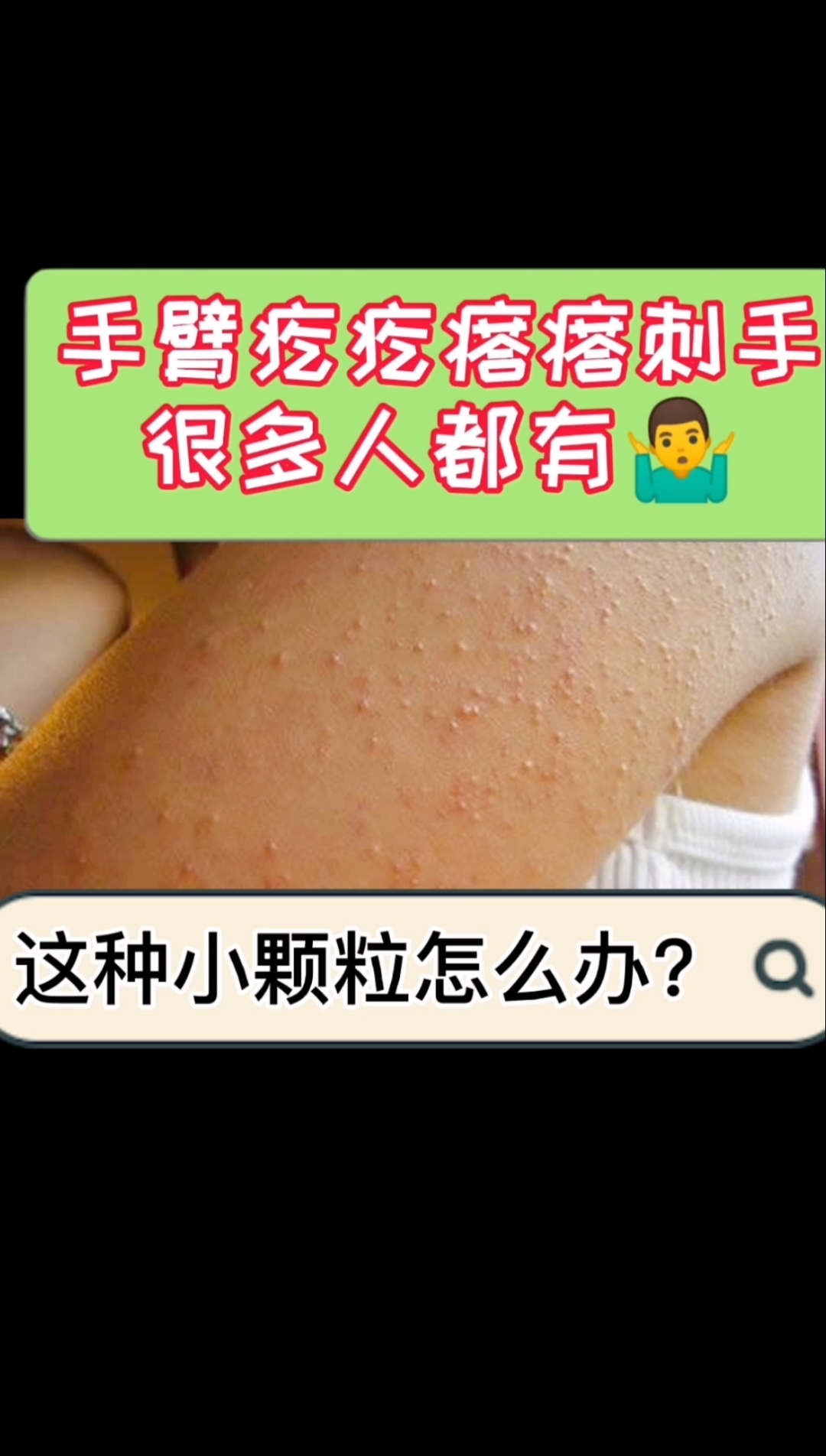 #每天一点冷知识#很多人手臂小疙瘩，摸上去刺手，这是什么你要知道