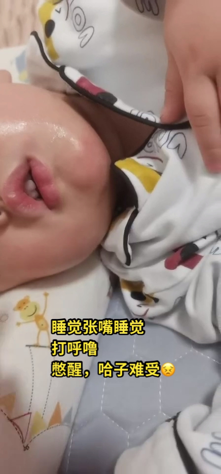 孩子窦yan腺样体肥大,现在睡觉不打呼噜,不张嘴睡觉,终于可以睡个好觉