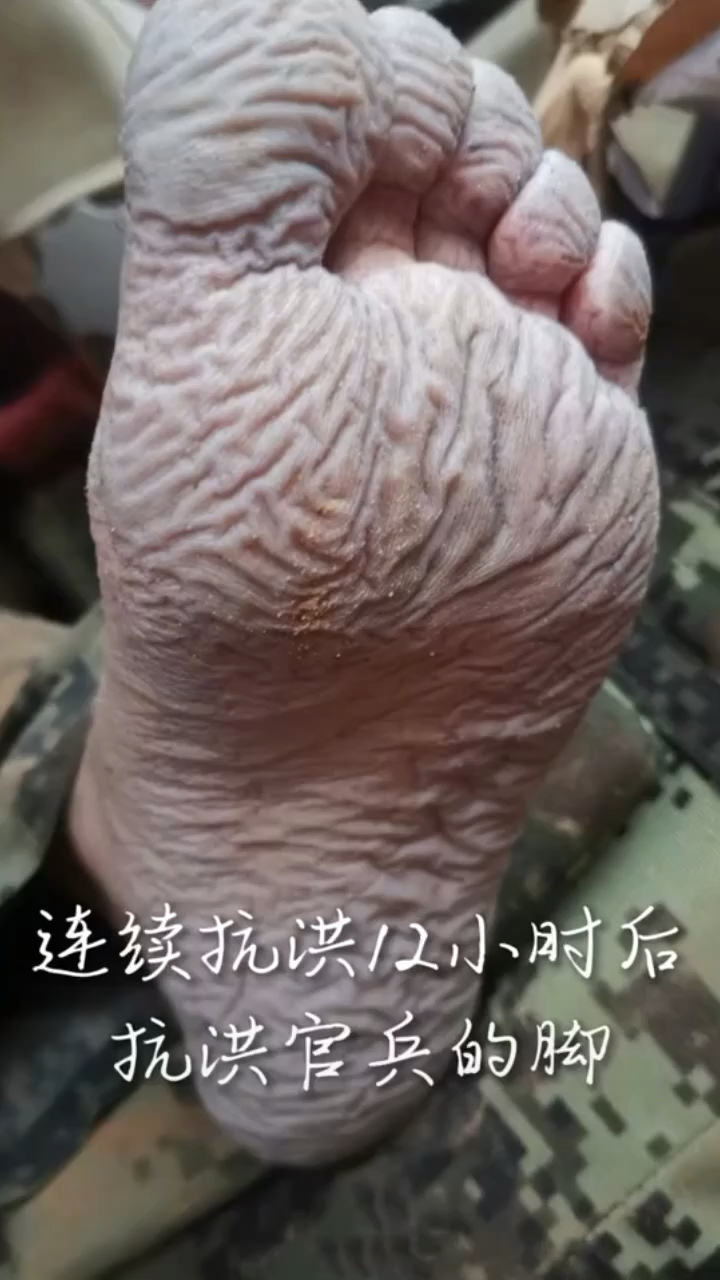连续抗洪12小时后战士的脚