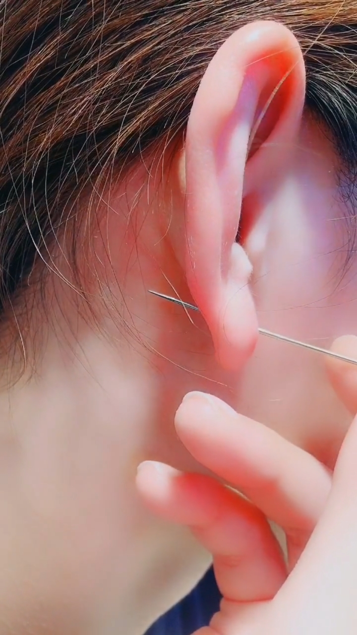用针也可以打耳洞嘛?