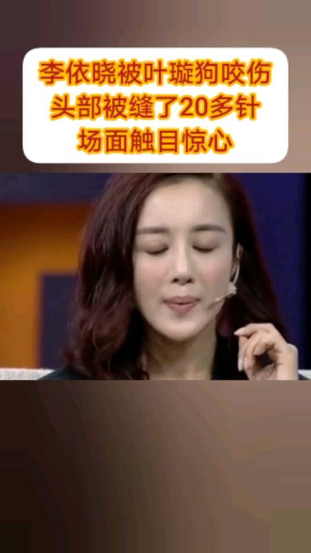 李依晓被#叶璇狗咬伤,头部缝了20多针,场面触目惊心