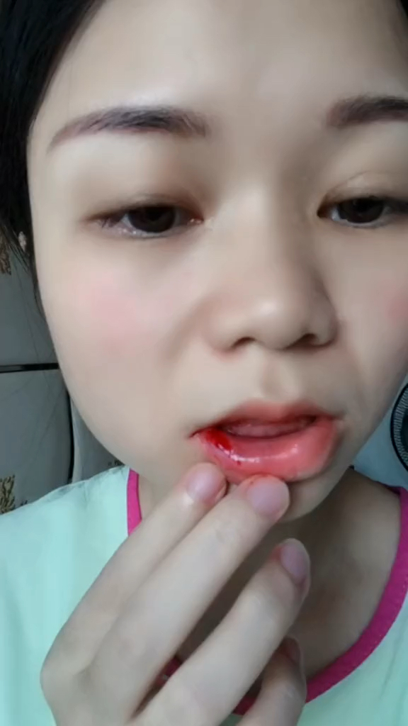 单身太久了,梦到和前男友接吻,用力过猛,醒来发现自己把自己嘴唇咬破