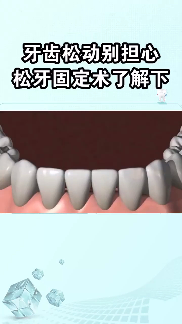 牙齿松动别担心固定术了解一下
