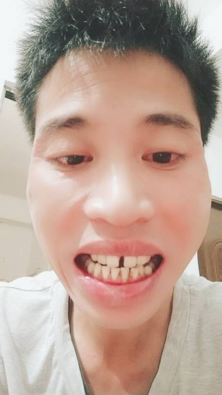 听别人说牙缝太大了漏财你们有听过这种说法吗