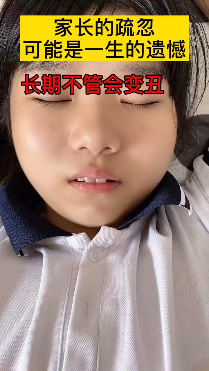 孩子张嘴睡觉要及时纠正久了会变丑的哦等嘴凸了就不好看咯