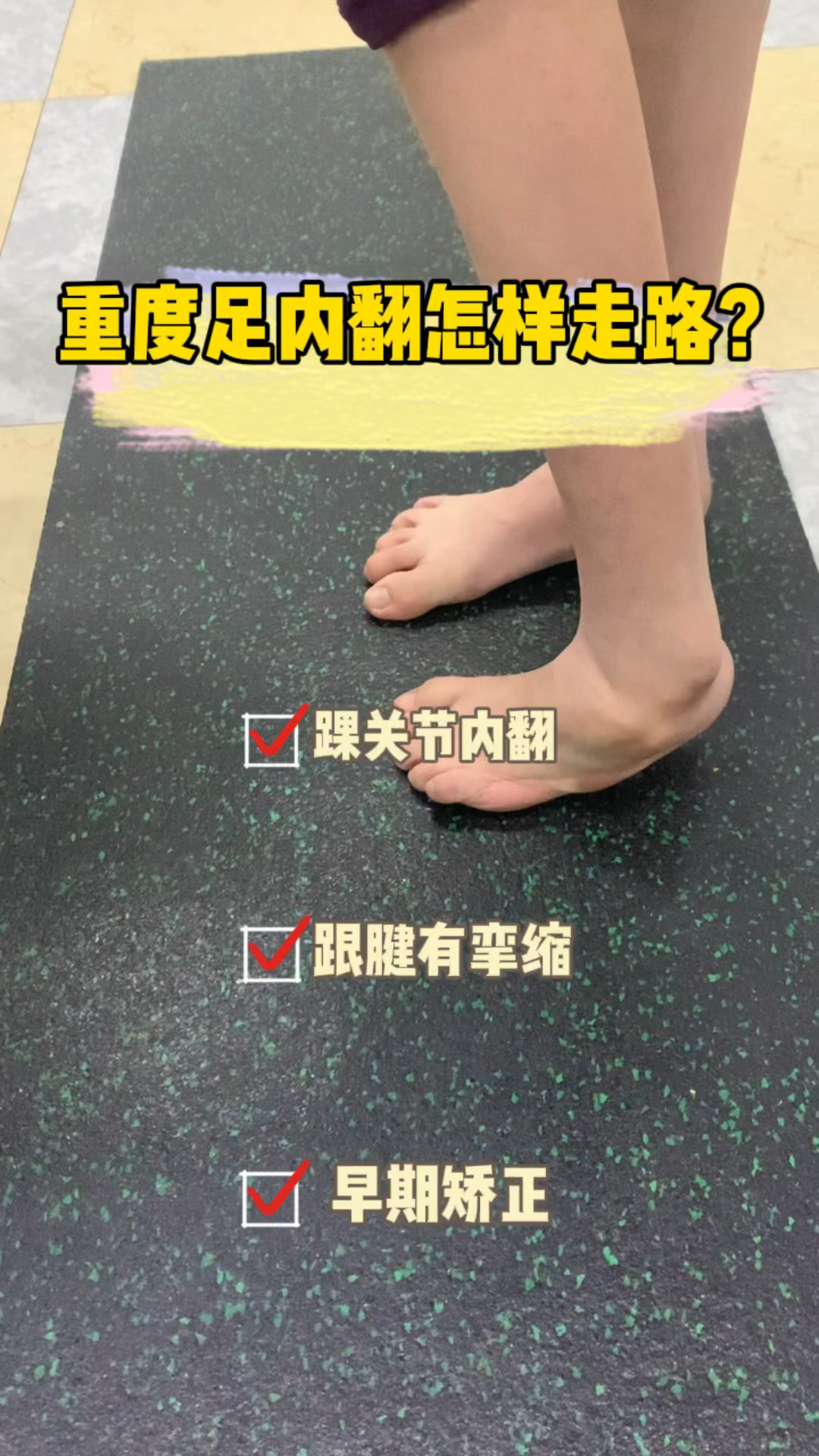 足内翻重度足内翻是怎样走路的门诊一例足内翻儿童的步态特点早期干预