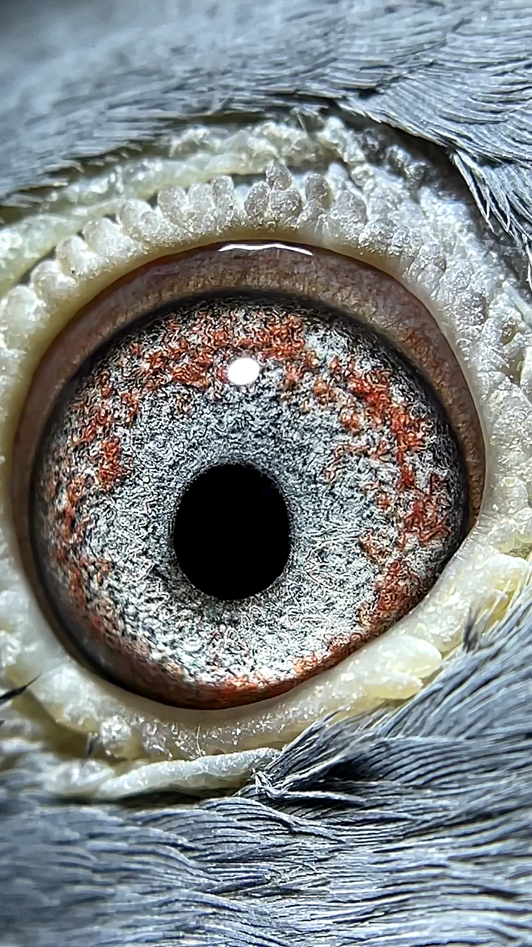 鸽子#白内障患者