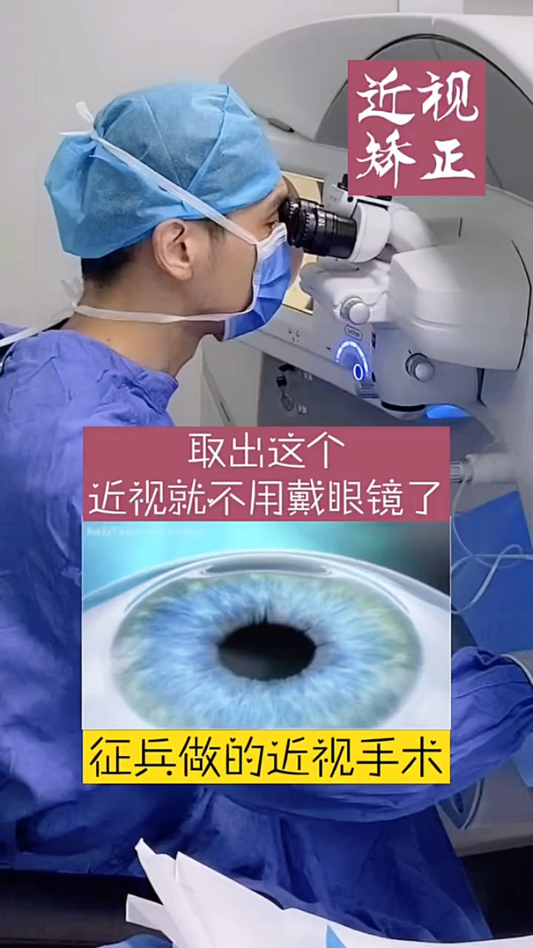 近视这就是全飞秒近视手术