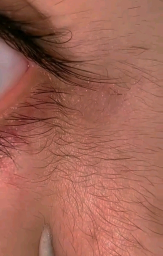 图哪涨哪里,这如何是好了,图的眼角都长毛毛了,怎么会这样