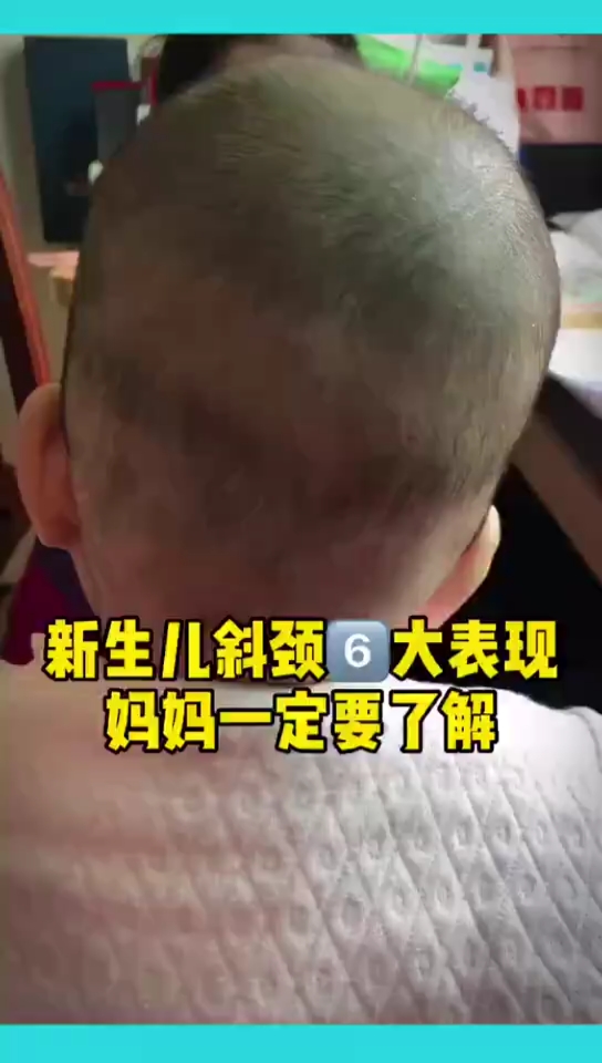 你们家宝宝有这些斜颈表现么