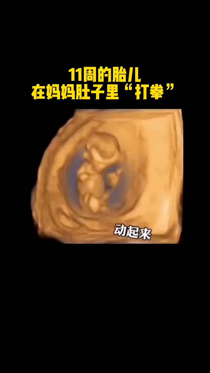 11周的胎儿在妈妈肚子里打拳