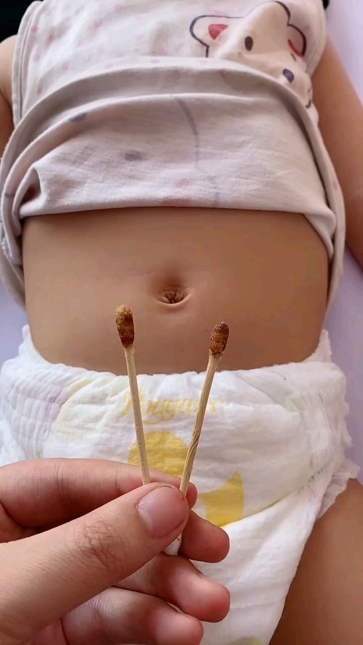 育儿新生儿的肚脐应该如何护理呢