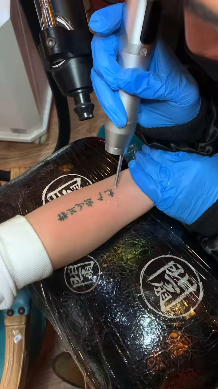 洗纹身#低温超皮秒洗纹身～洗去一段难忘的记忆,就让那段记忆永远