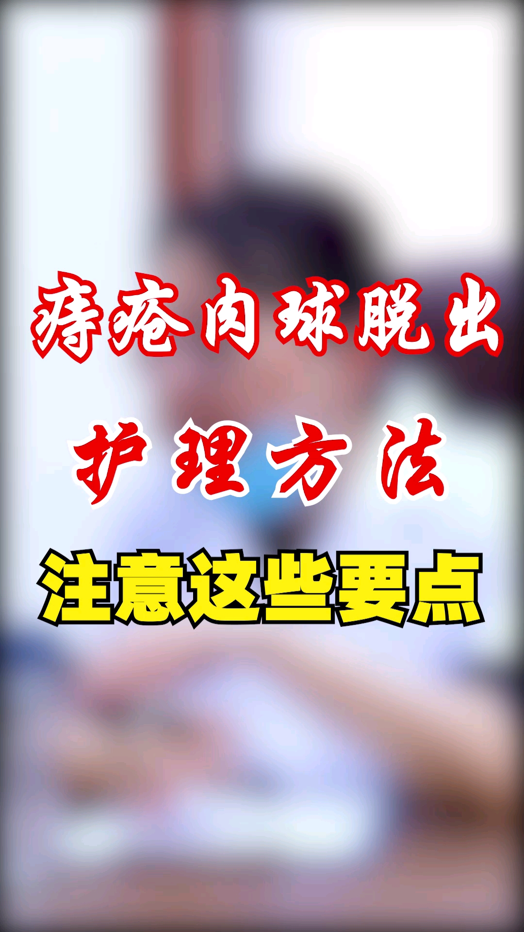 痔疮肉球脱出的护理方法,注意这些要点