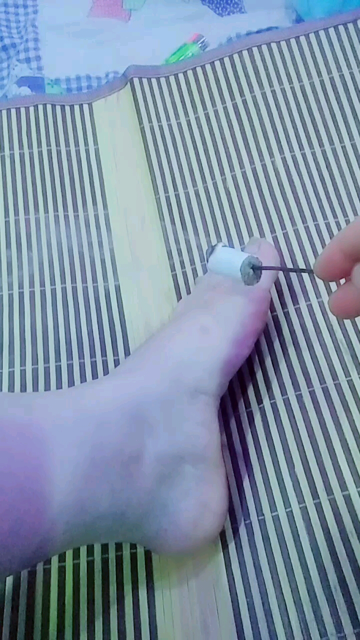 民间土方法#先下下班了用艾灸烤烤我的小脚丫