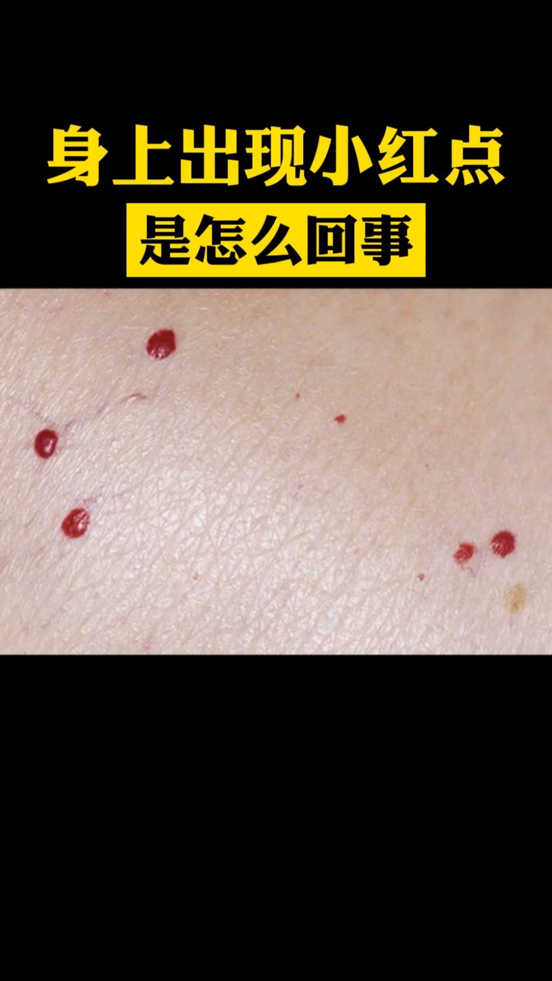 小红点身上出现小红点这是怎么回事