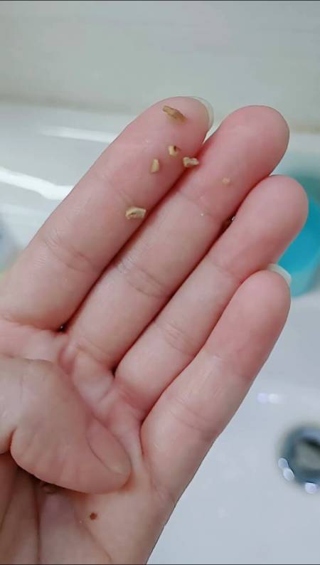 用了一段时间芽不仅白了,口气清新了,就连讨厌的牙结石也掉了-全民小