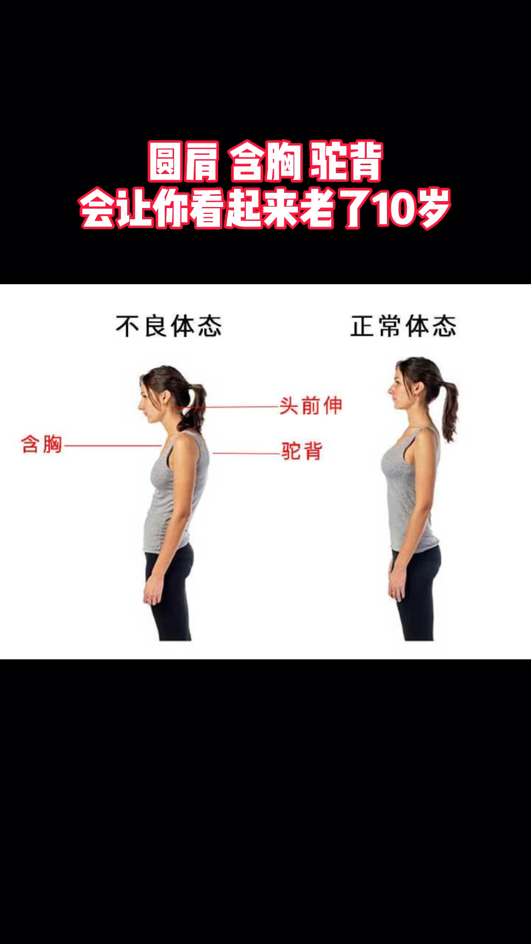 含胸驼背#圆肩,驼背,含胸会让你看起来老了10岁.