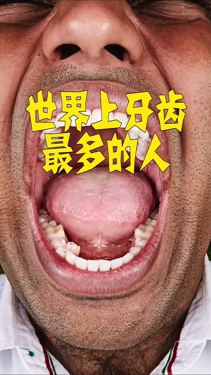 世界上牙齿最多的人你知道是什么吗看完你就知道了