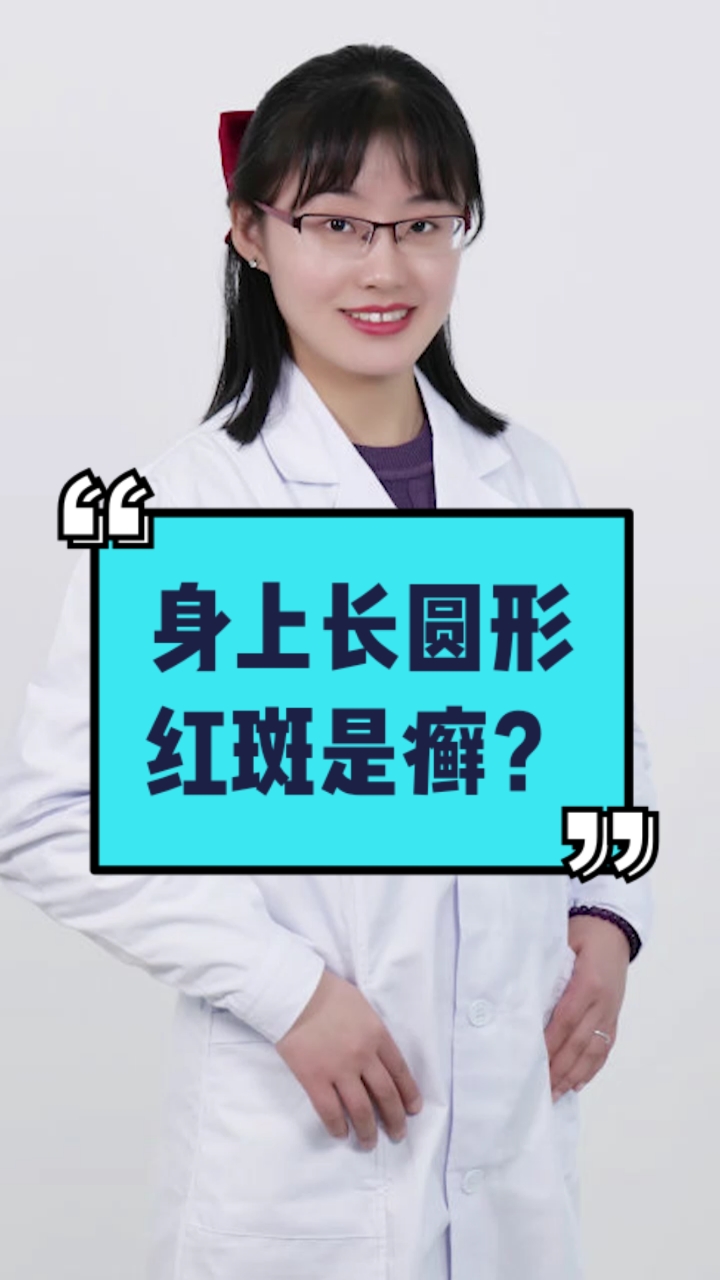 每天一点健康小知识身上长圆形红斑是癣