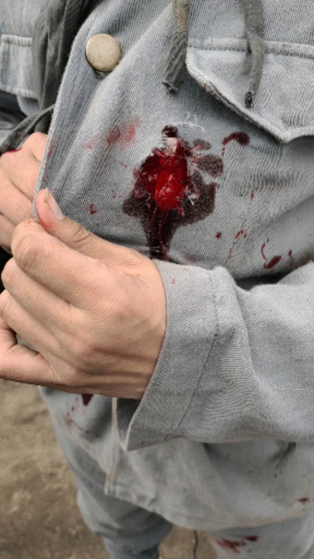 电视里的枪伤原来是这样的