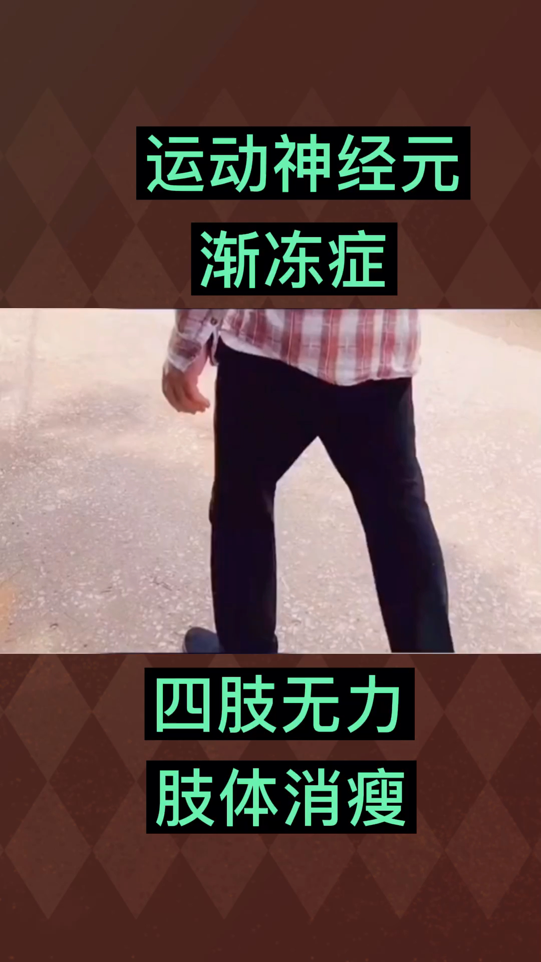 运动神经元#渐冻症,四肢无力