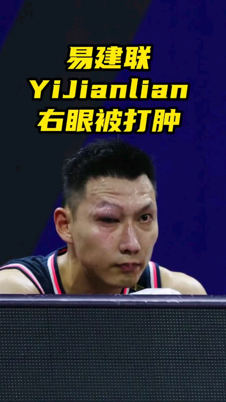 篮球#广东球员频频受伤,易建联眼睛被打肿裁判无动于衷,大哥暴怒找