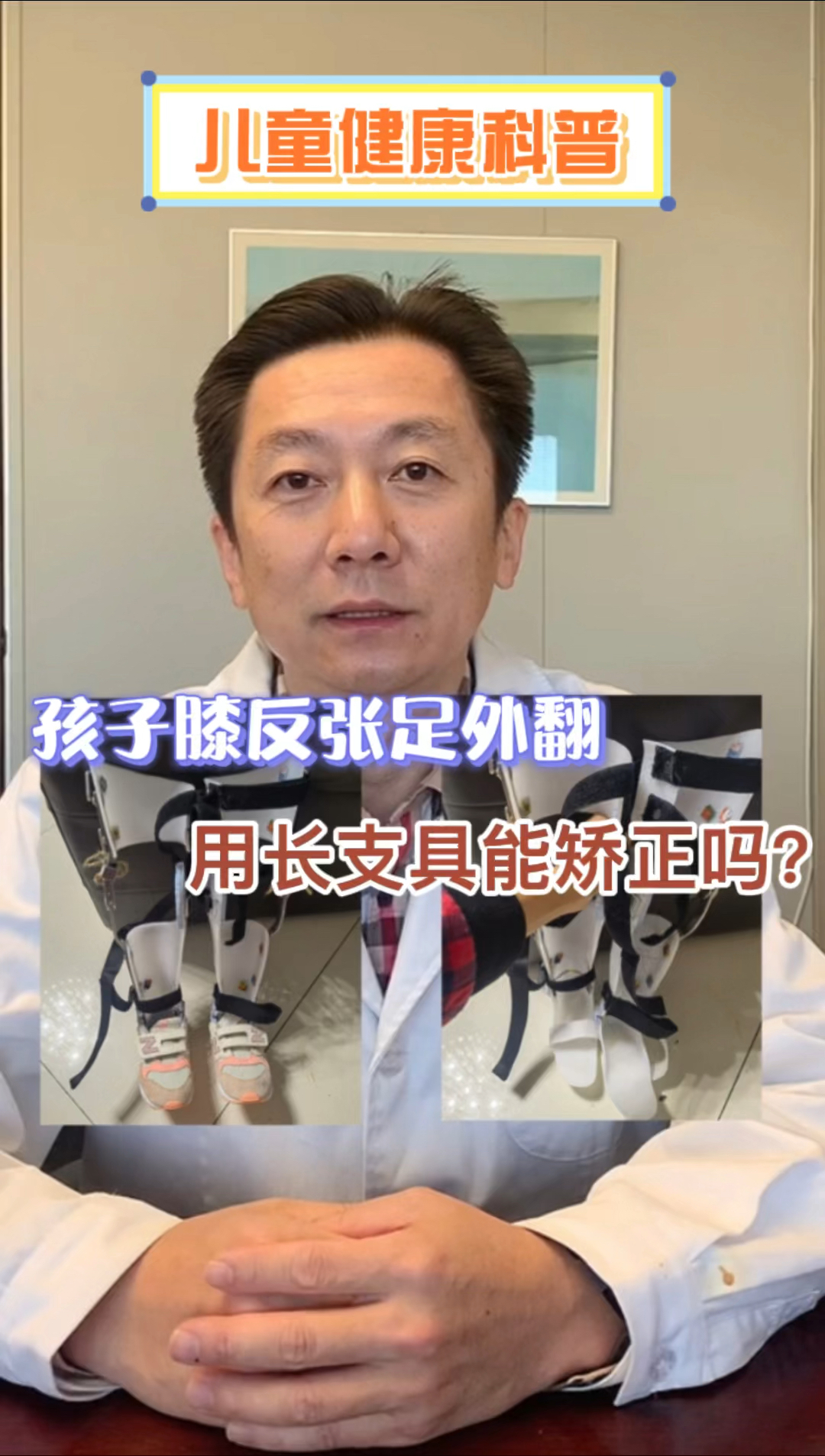 健康养生孩子有足外翻和膝外翻机构让用长支具kafo矫形器矫正矫形结果