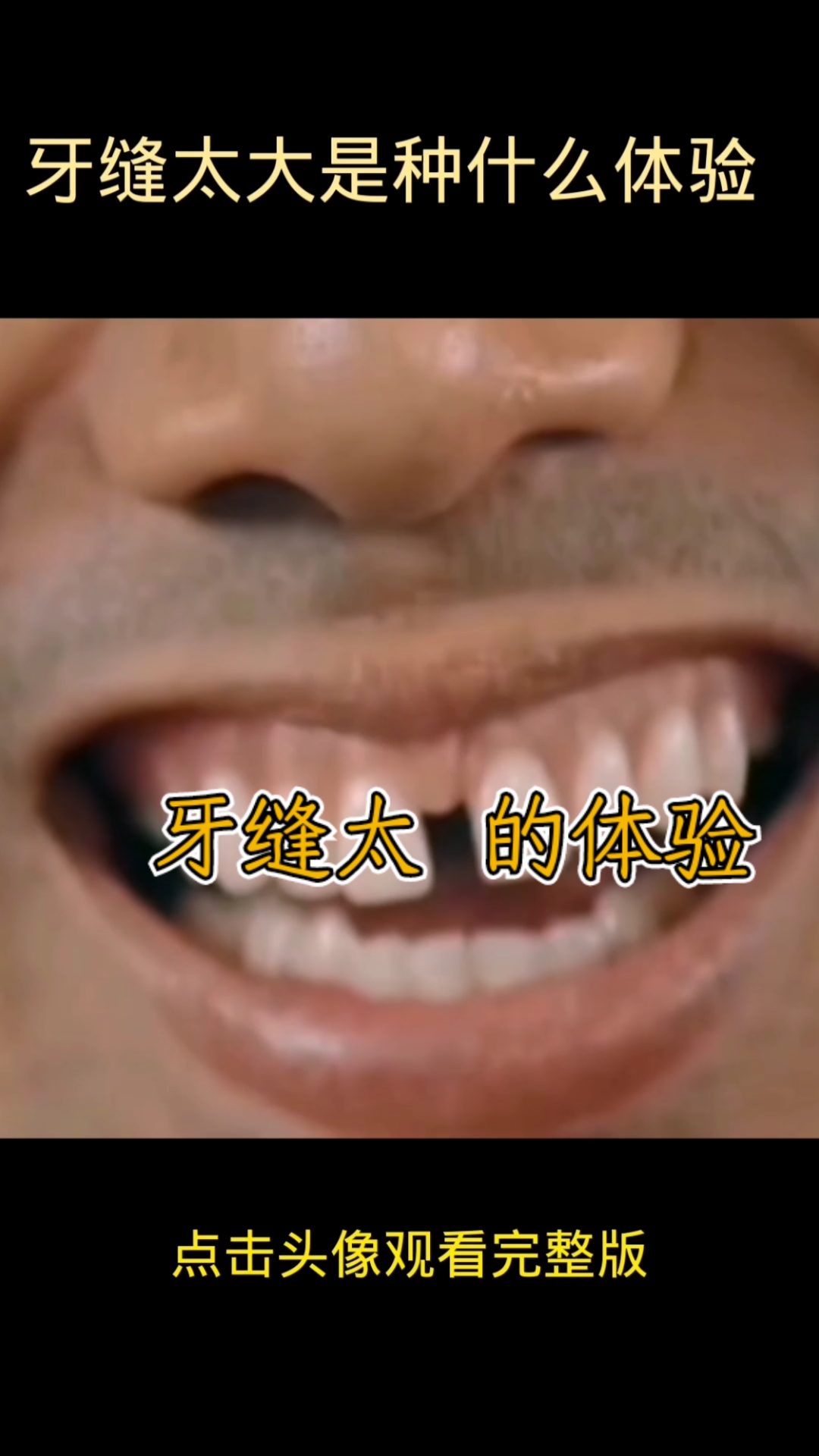 搞笑段子剧#牙缝太大的体验