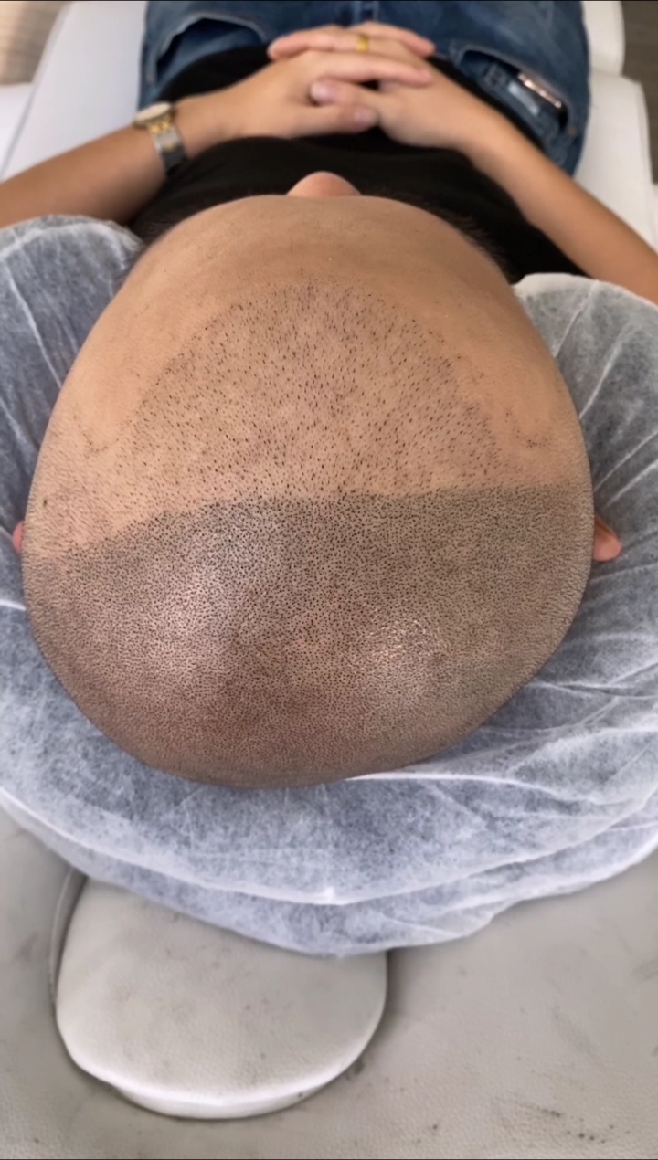 纹发#黑米3d纹发