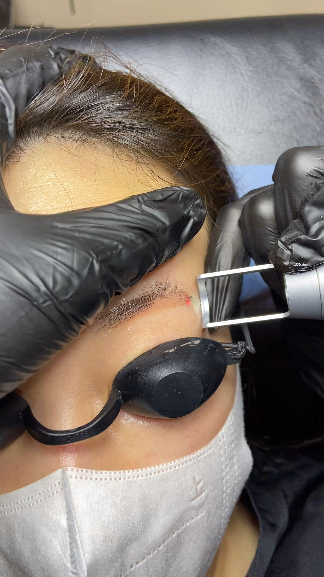 洗眉毛#皮秒洗眉