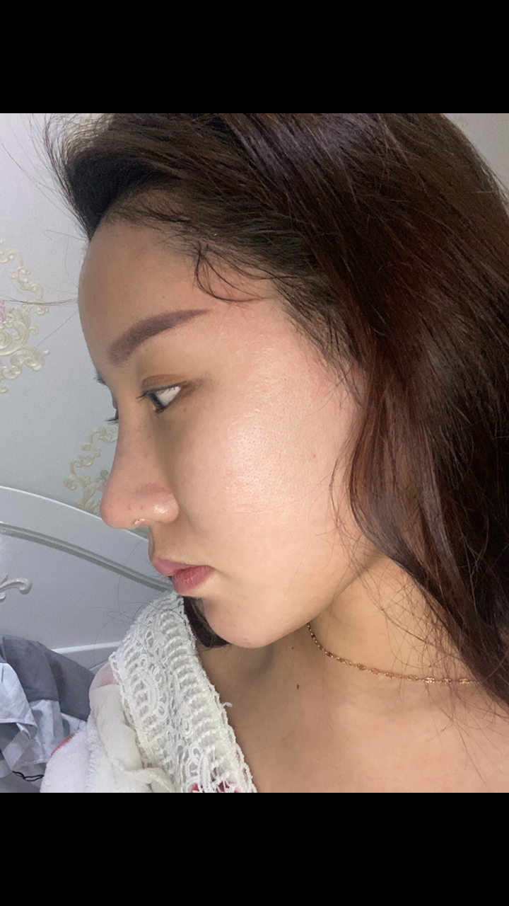 鼻子刚好十天都说我做的是假鼻子,有不好看还高