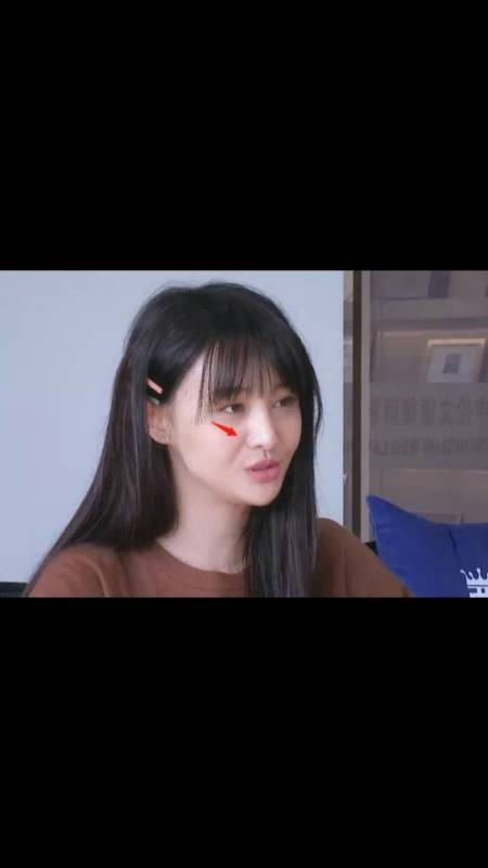 郑爽活动现身黑眼圈严重状态很差一说话就闭眼被指不敢正眼看人