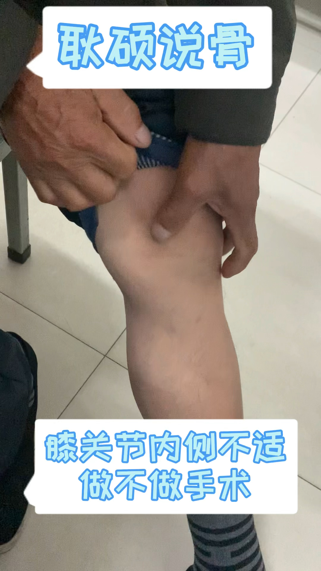 膝关节膝关节内侧疼痛不适该不该做手术不是医生说的算人文关怀很重要