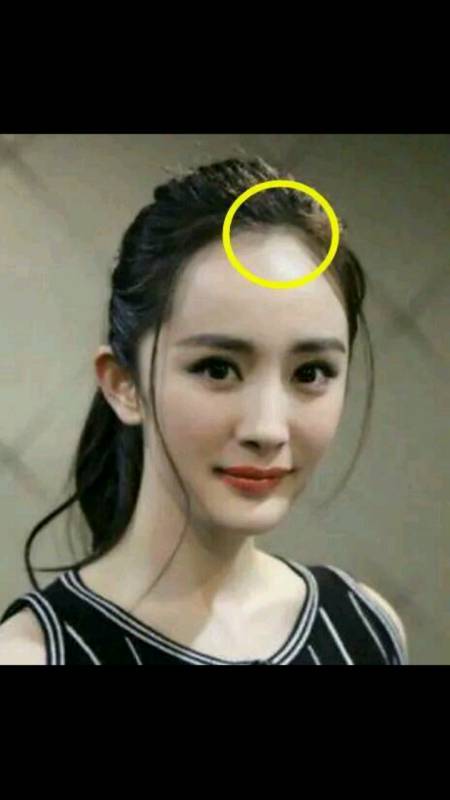 杨幂新剧路透曝光发际线严重后移令人瞩目女明星脱发也很忧伤