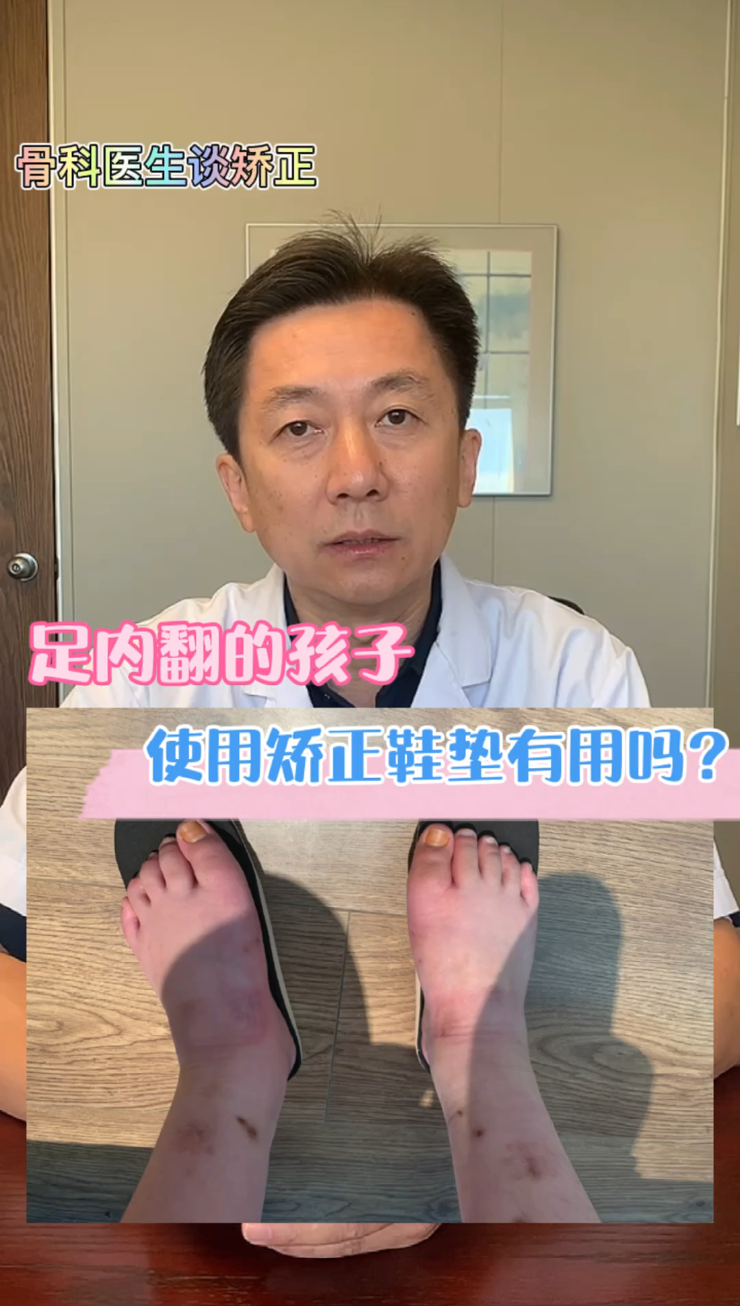 育儿儿童足内翻单纯使用矫正鞋垫能有效果吗骨科医生谈一下足内翻和