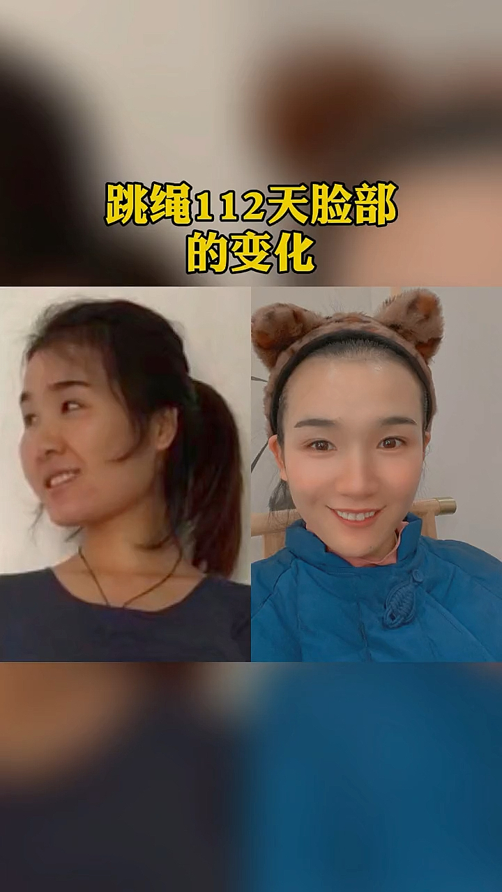 超级种草官挑战赛#跳绳112天脸部的变化,不要低估减肥带来的改变!
