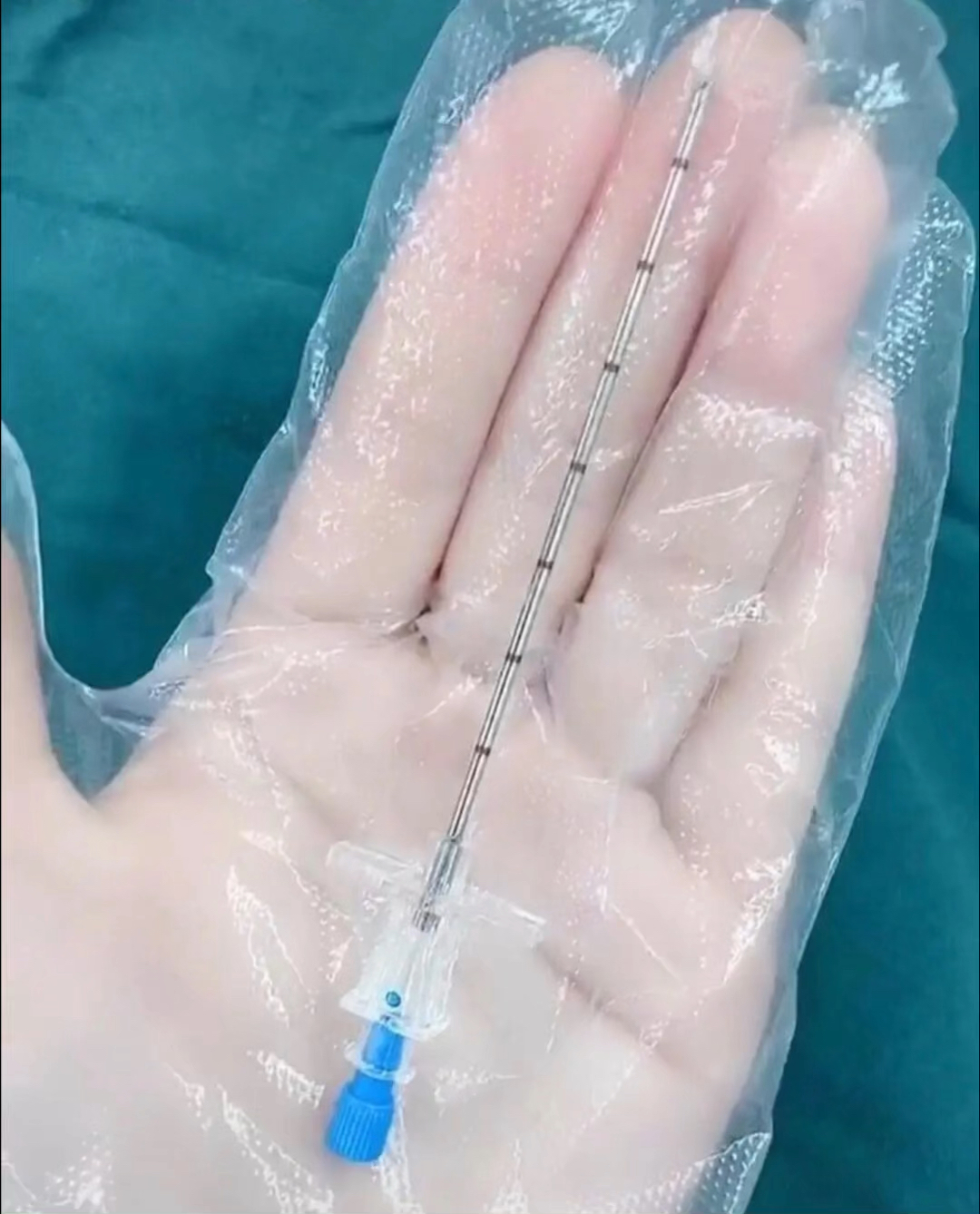 家有萌娃#为你生孩子时候打在脊椎上的麻醉针,不是骨开十指就是剖腹