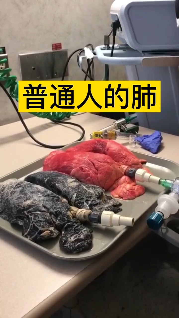 正常的肺和吸烟的肺pk你还吸烟吗